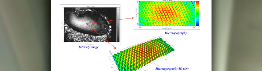 Acuity White Light Confocal Medical Scans