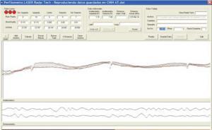 Pavement Measurements with Laser Sensors